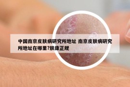 中国南京皮肤病研究所地址 南京皮肤病研究所地址在哪里?肤康正规