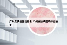 广州皮肤病医院排名 广州皮肤病医院排名前十