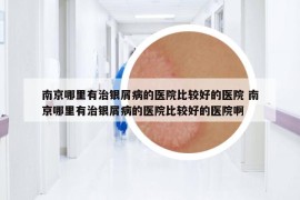 南京哪里有治银屑病的医院比较好的医院 南京哪里有治银屑病的医院比较好的医院啊