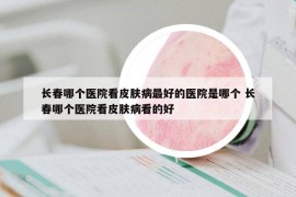 长春哪个医院看皮肤病最好的医院是哪个 长春哪个医院看皮肤病看的好