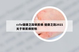 cctv健康之路银屑病 健康之路2021关于银屑病视频