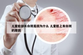 儿童脸部长白斑是因为什么 儿童脸上有白斑的原因