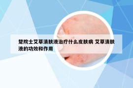 楚院士艾草清肤液治疗什么皮肤病 艾草清肤液的功效和作用