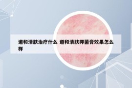 道和清肤治疗什么 道和清肤抑菌膏效果怎么样