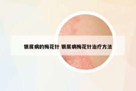银屑病的梅花针 银屑病梅花针治疗方法