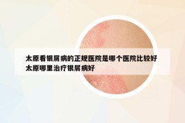 太原看银屑病的正规医院是哪个医院比较好 太原哪里治疗银屑病好