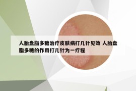 人胎盘脂多糖治疗皮肤病打几针见效 人胎盘脂多糖的作用打几针为一疗程