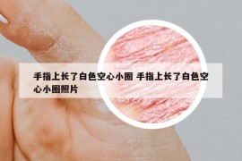 手指上长了白色空心小圈 手指上长了白色空心小圈照片