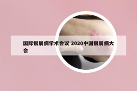 国际银屑病学术会议 2020中国银屑病大会