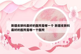 新疆皮肤科最好的医院是哪一个 新疆皮肤科最好的医院是哪一个医院