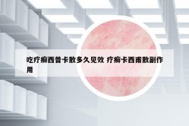 吃疗癣西普卡散多久见效 疗癣卡西甫散副作用