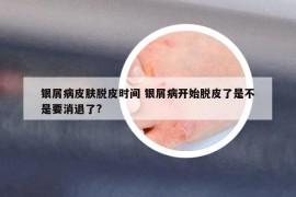 银屑病皮肤脱皮时间 银屑病开始脱皮了是不是要消退了?