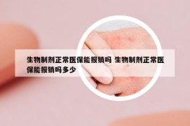 生物制剂正常医保能报销吗 生物制剂正常医保能报销吗多少