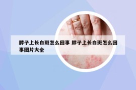 脖子上长白斑怎么回事 脖子上长白斑怎么回事图片大全