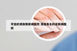 可信的渭南银屑病医院 渭南有名的皮肤病医院