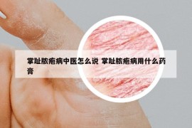 掌趾脓疱病中医怎么说 掌趾脓疱病用什么药膏