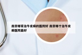 南京哪家治牛皮癣的医院好 南京哪个治牛皮癣医院最好