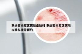 重庆西南军区医院皮肤科 重庆西南军区医院皮肤科挂号预约