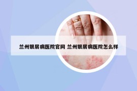 兰州银屑病医院官网 兰州银屑病医院怎么样
