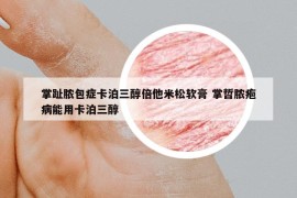 掌趾脓包症卡泊三醇倍他米松软膏 掌哲脓疱病能用卡泊三醇