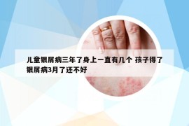 儿童银屑病三年了身上一直有几个 孩子得了银屑病3月了还不好