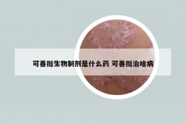 可善挺生物制剂是什么药 可善挺治啥病