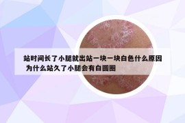 站时间长了小腿就出站一块一块白色什么原因 为什么站久了小腿会有白圆圈