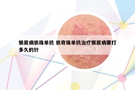 银屑病依珠单抗 依奇珠单抗治疗银屑病要打多久的针