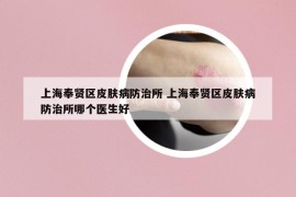 上海奉贤区皮肤病防治所 上海奉贤区皮肤病防治所哪个医生好