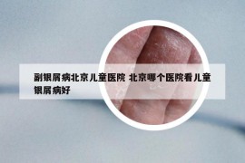 副银屑病北京儿童医院 北京哪个医院看儿童银屑病好