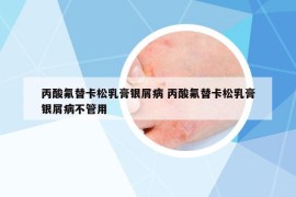 丙酸氟替卡松乳膏银屑病 丙酸氟替卡松乳膏银屑病不管用