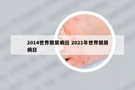 2014世界银屑病日 2021年世界银屑病日