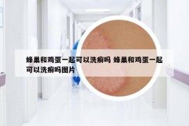 蜂巢和鸡蛋一起可以洗癣吗 蜂巢和鸡蛋一起可以洗癣吗图片