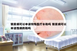 银屑病可以申请特殊医疗补助吗 银屑病可以申请慢病救助吗