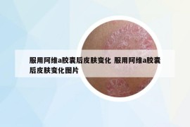 服用阿维a胶囊后皮肤变化 服用阿维a胶囊后皮肤变化图片