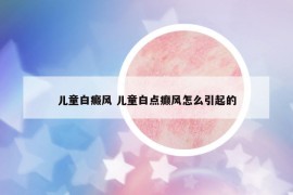 儿童白癜风 儿童白点癫风怎么引起的