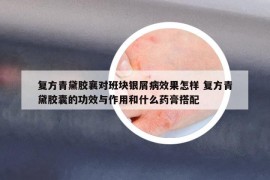 复方青黛胶襄对班块银屑病效果怎样 复方青黛胶囊的功效与作用和什么药膏搭配