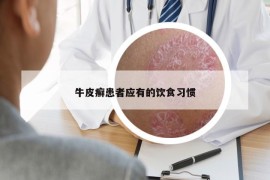 牛皮癣患者应有的饮食习惯