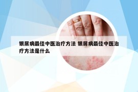 银屑病最佳中医治疗方法 银屑病最佳中医治疗方法是什么