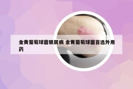 金黄葡萄球菌银屑病 金黄葡萄球菌首选外用药