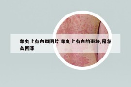睾丸上有白斑图片 睾丸上有白的斑块,是怎么回事
