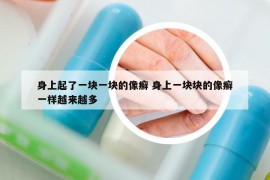 身上起了一块一块的像癣 身上一块块的像癣一样越来越多