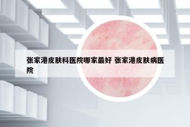张家港皮肤科医院哪家最好 张家港皮肤病医院