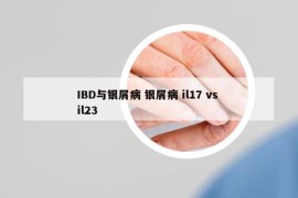 IBD与银屑病 银屑病 il17 vs il23