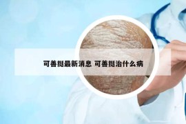 可善挺最新消息 可善挺治什么病