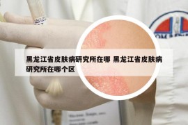 黑龙江省皮肤病研究所在哪 黑龙江省皮肤病研究所在哪个区