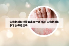 生物制剂打过量会出现什么情况 生物制剂打多了会得癌症吗