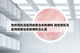 地奈德乳膏能彻底根治皮肤病吗 地奈德乳膏能彻底根治皮肤病吗怎么用