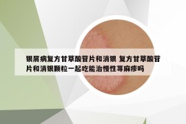 银屑病复方甘草酸苷片和消银 复方甘草酸苷片和消银颗粒一起吃能治慢性荨麻疹吗