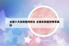 全国十大皮肤医院排名 全国皮肤医院哪家最好